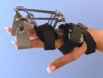 #10 Composite Spring and Elastic Splint to extend the distal interphalangeal joints. 